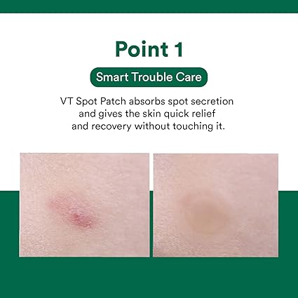 Vt Spot Patch(3Sets, 48Ea)