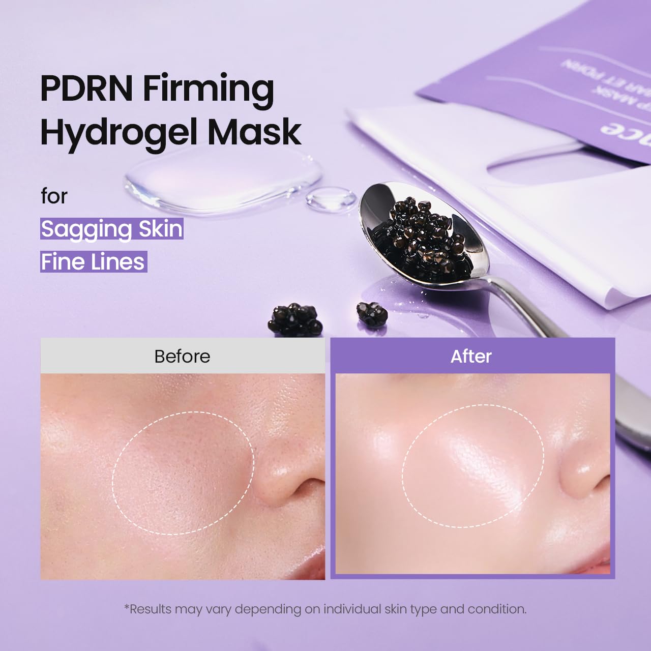 Rejuvenating Caviar Pdrn Real Deep Mask 4Ea
