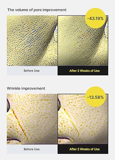 The Vita-A Retinol Shot Tightening Serum 30Ml