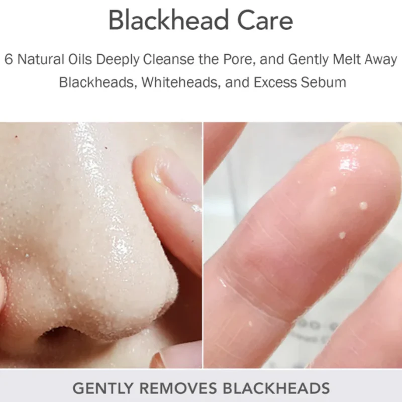 Fresh Blackhead Jojoba Cleansing Oil 150Ml