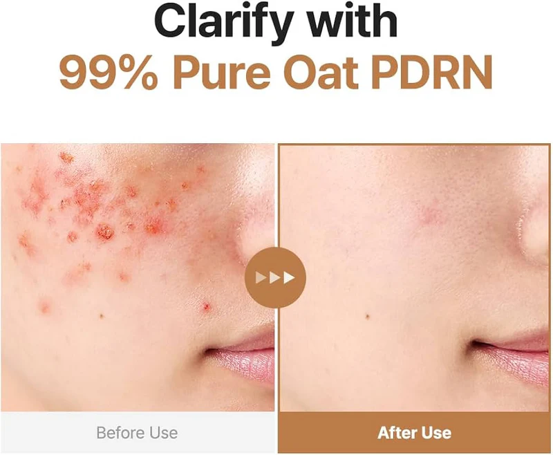 Oat Pdrn Gentle Refining Toner 200Ml