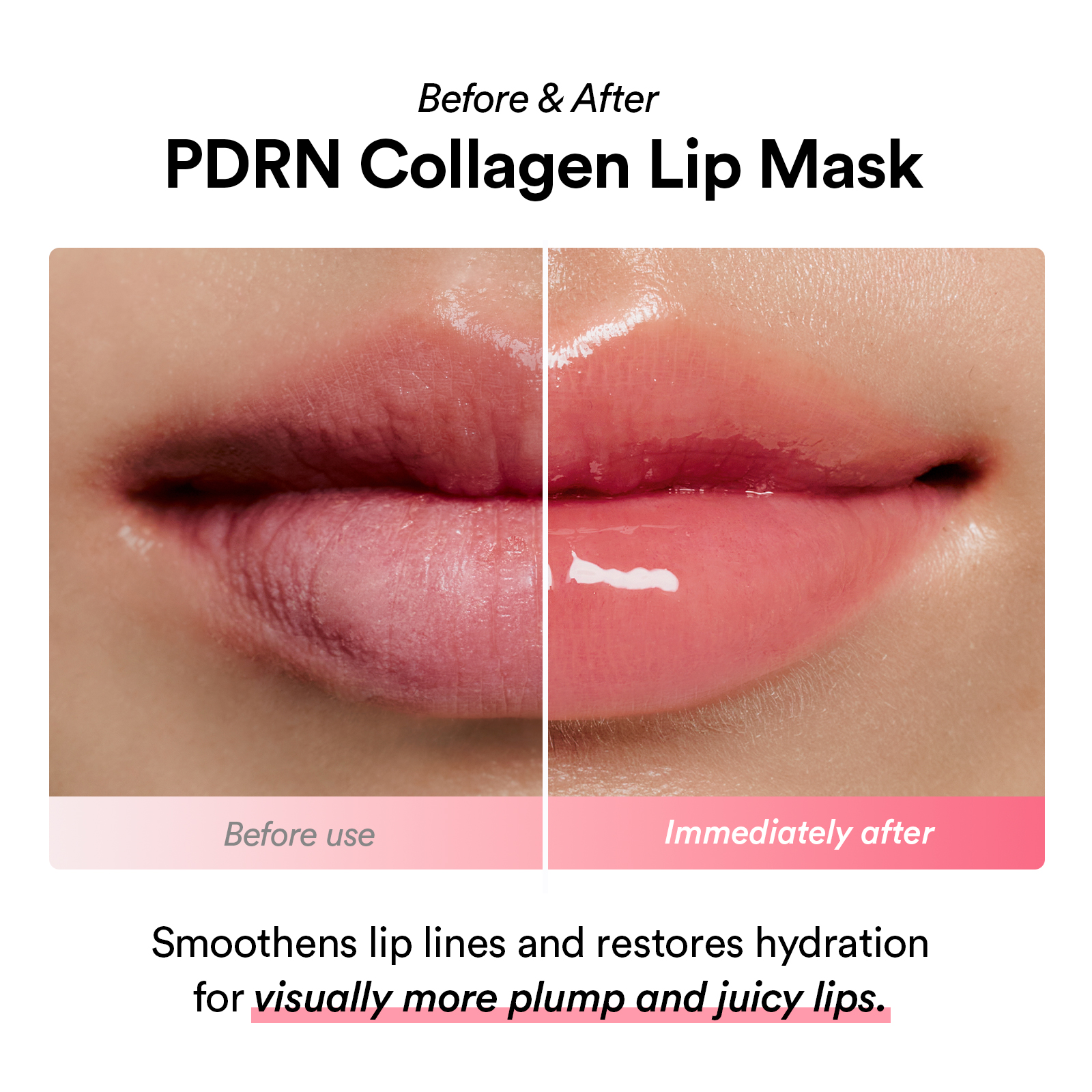 Pdrn Collagen Lip Mask Glazed Jelly 11G