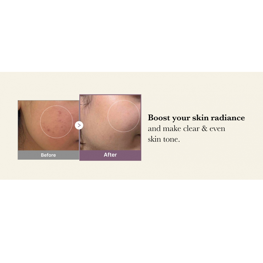 Age-R Glutathione Glow Toner 140Ml