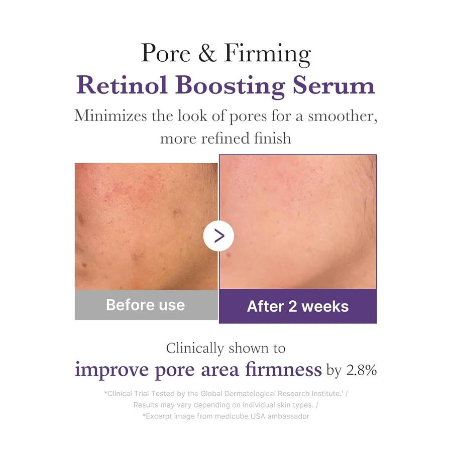 Retinol Nmn Boosting Serum 30Ml