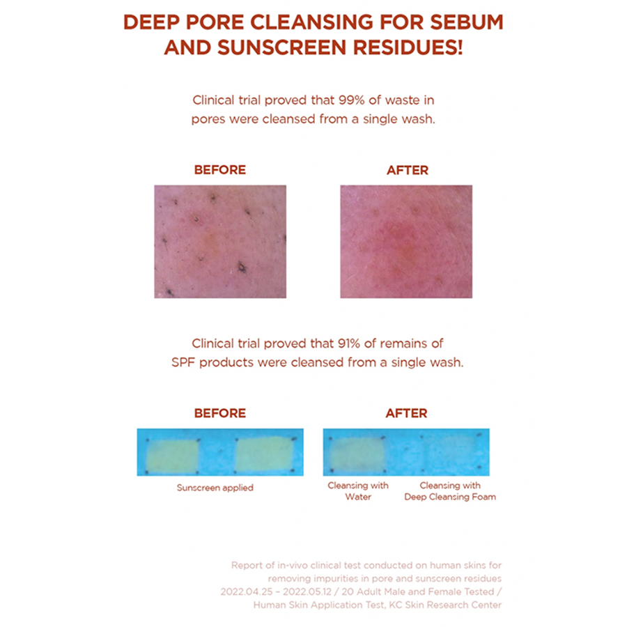 Madagascar Centella Poremizing Deep Cleansing Foam 125Ml